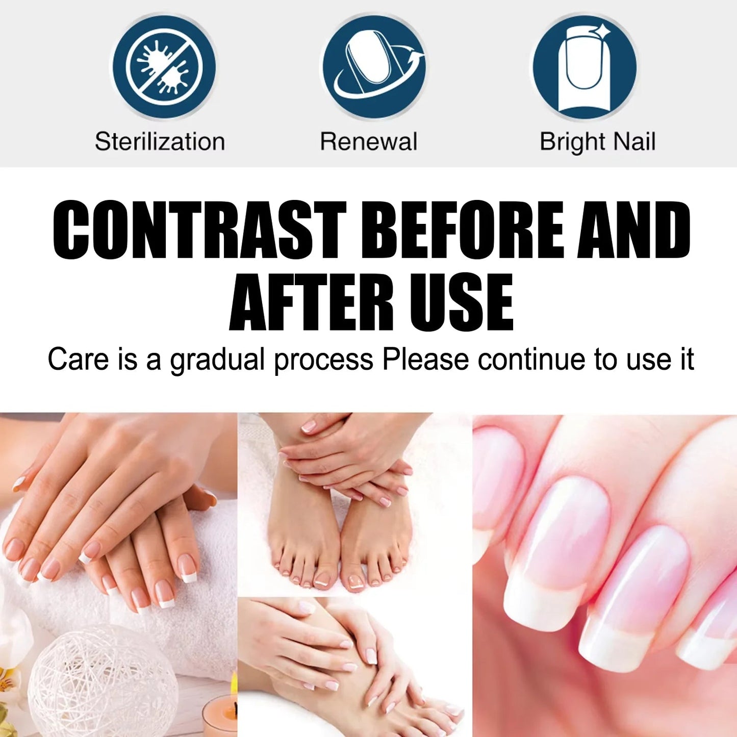 South Moon Nail Fungus Repair Pen Remove Onychomycosis Paronychia Reduce Toe Infection Brighten Nail Hand Foot Nail Care Liquid - SwiftTrends™