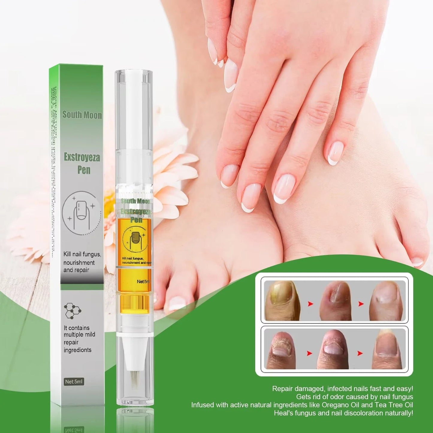 South Moon Nail Fungus Repair Pen Remove Onychomycosis Paronychia Reduce Toe Infection Brighten Nail Hand Foot Nail Care Liquid - SwiftTrends™