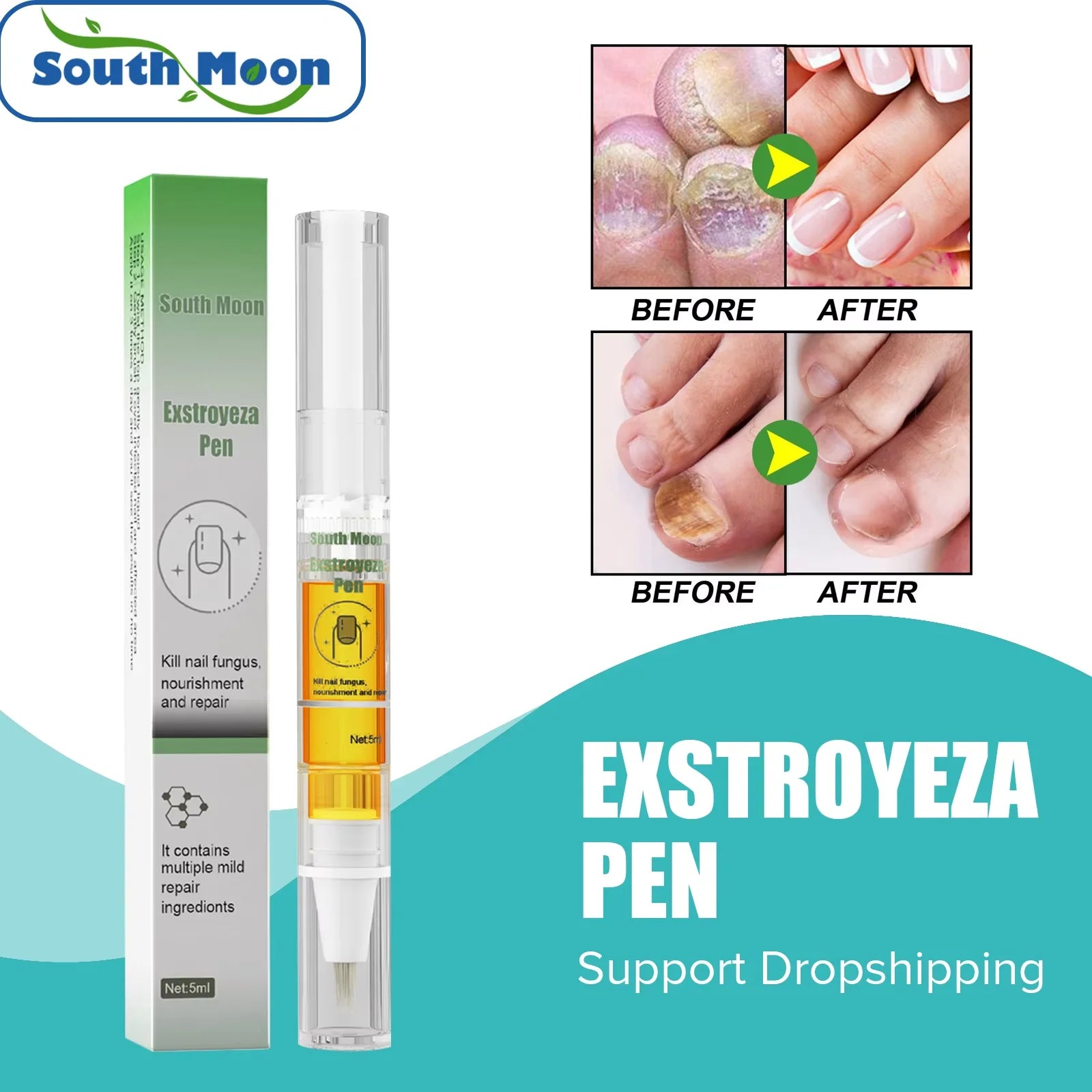 South Moon Nail Fungus Repair Pen Remove Onychomycosis Paronychia Reduce Toe Infection Brighten Nail Hand Foot Nail Care Liquid - SwiftTrends™